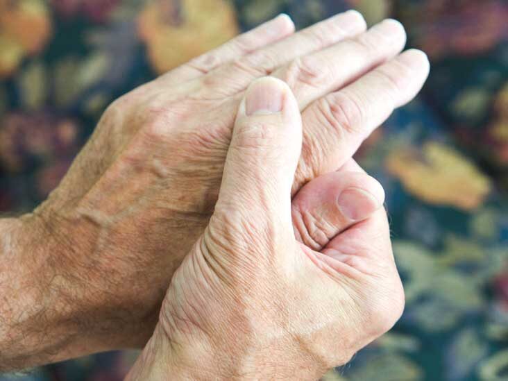 Arthritis vs. Rheumatism