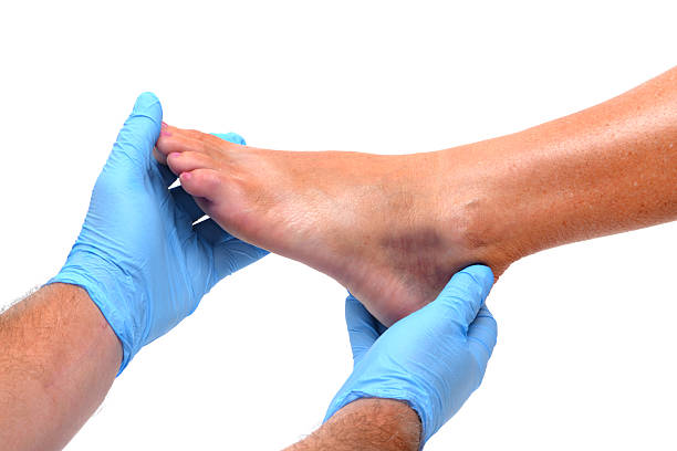 Foot Bruise