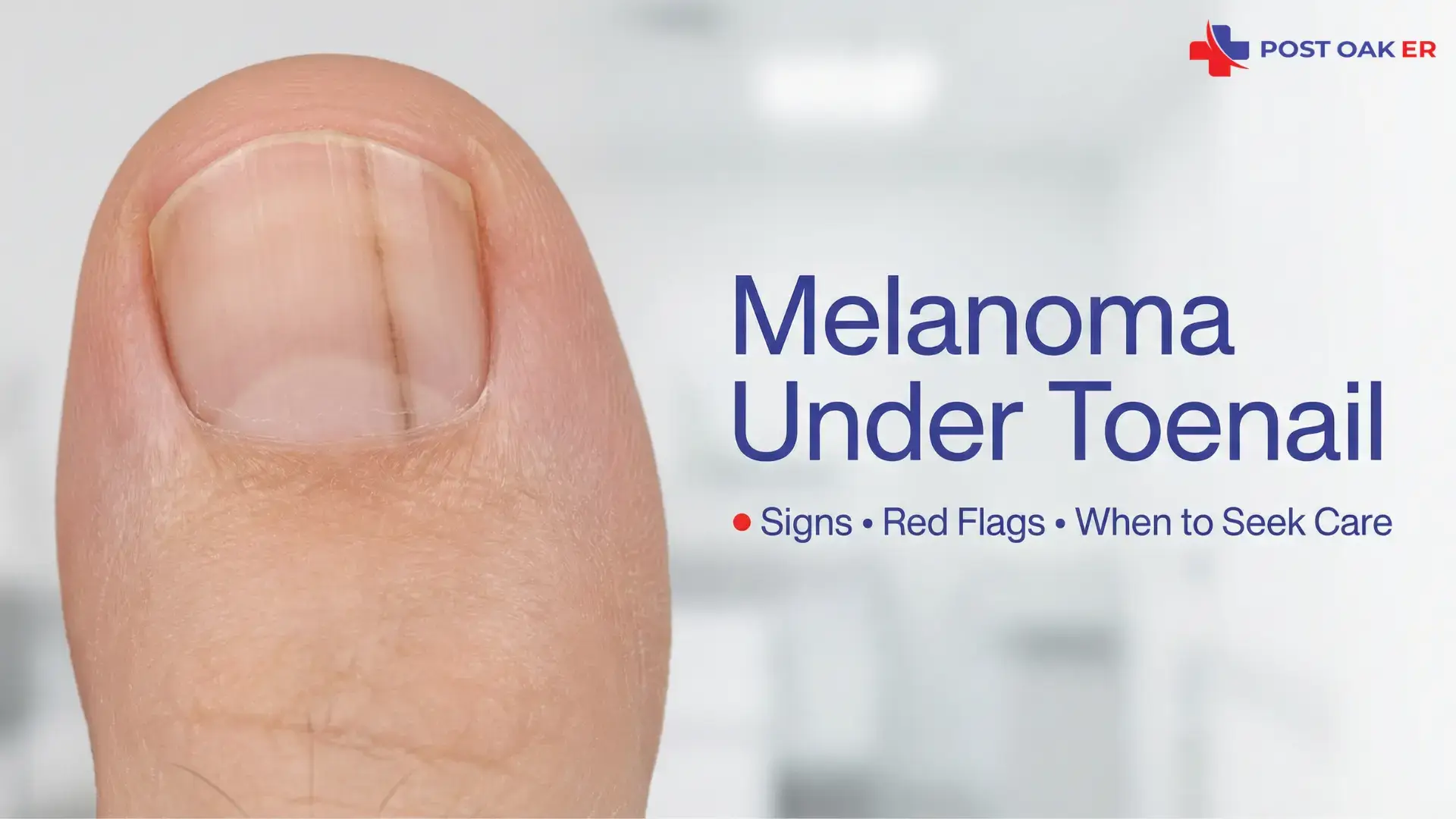 Close-up of a big toe with a thin dark vertical stripe under the toenail, with “Melanoma Under Toenail: Signs, Red Flags, When to Seek Care” text and Post Oak ER logo.