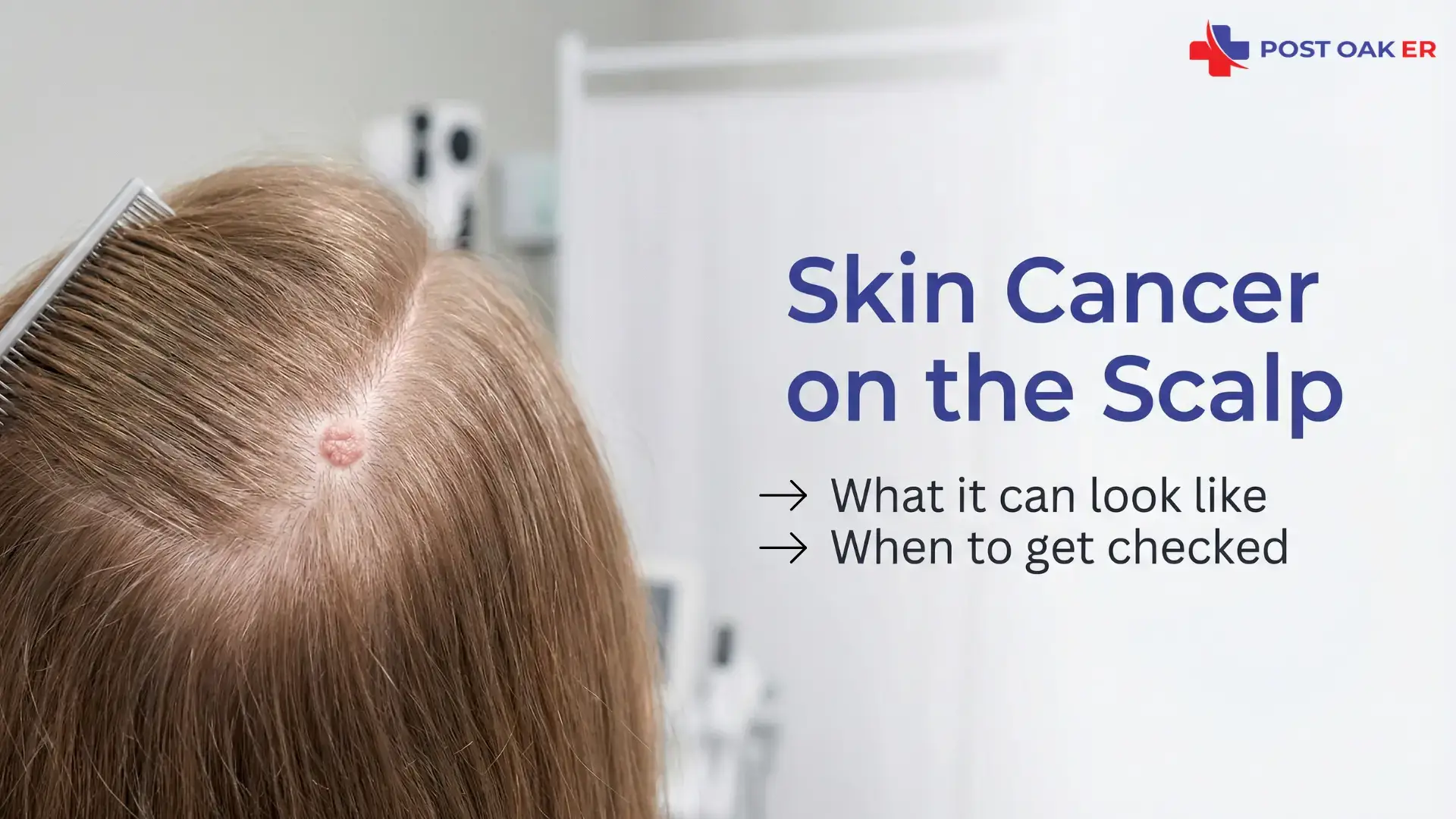 Person parting hair to show a small raised pink spot on the scalp, with “Skin Cancer on the Scalp” title and Post Oak ER logo.