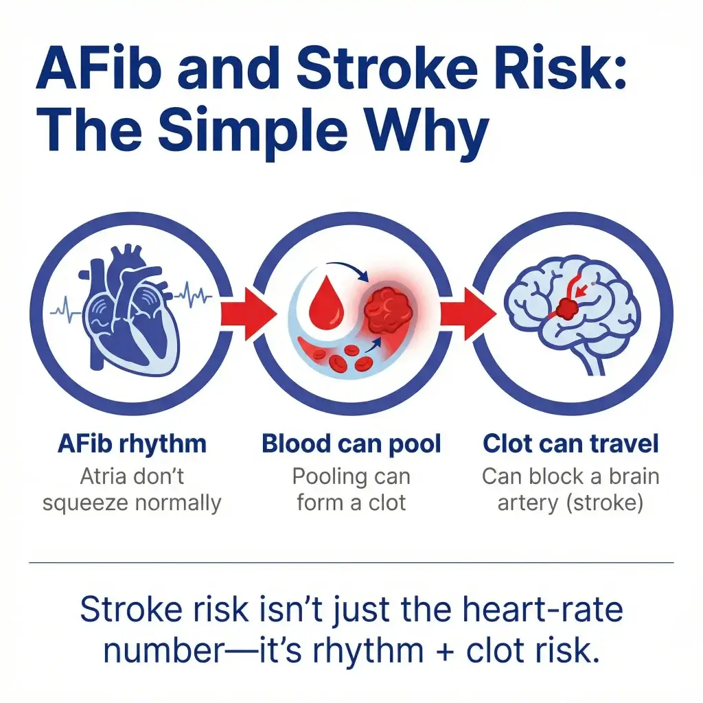 What Is a Dangerous Heart Rate With AFib? ER Warning Signs, Stroke Risk, and When to Call 911 2 Infographic titled “AFib and Stroke Risk: The Simple Why” showing how atrial fibrillation can cause blood to pool in the atria, form a clot, and allow the clot to travel to the brain and block an artery, noting stroke risk is about rhythm plus clot risk—not just heart rate.