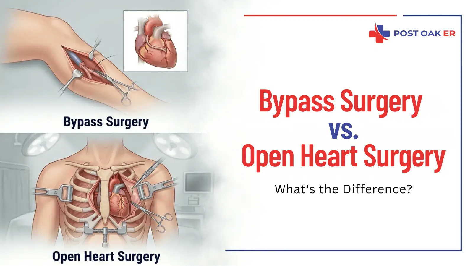 Medical illustration comparing bypass surgery and open heart surgery with labeled heart procedure diagrams and Post Oak ER branding.