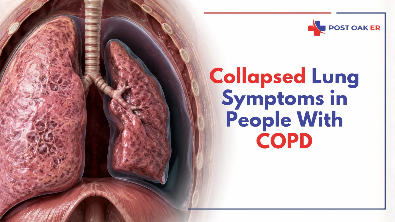 Medical illustration showing a collapsed lung (pneumothorax) in a person with COPD, highlighting reduced lung expansion and related symptoms.